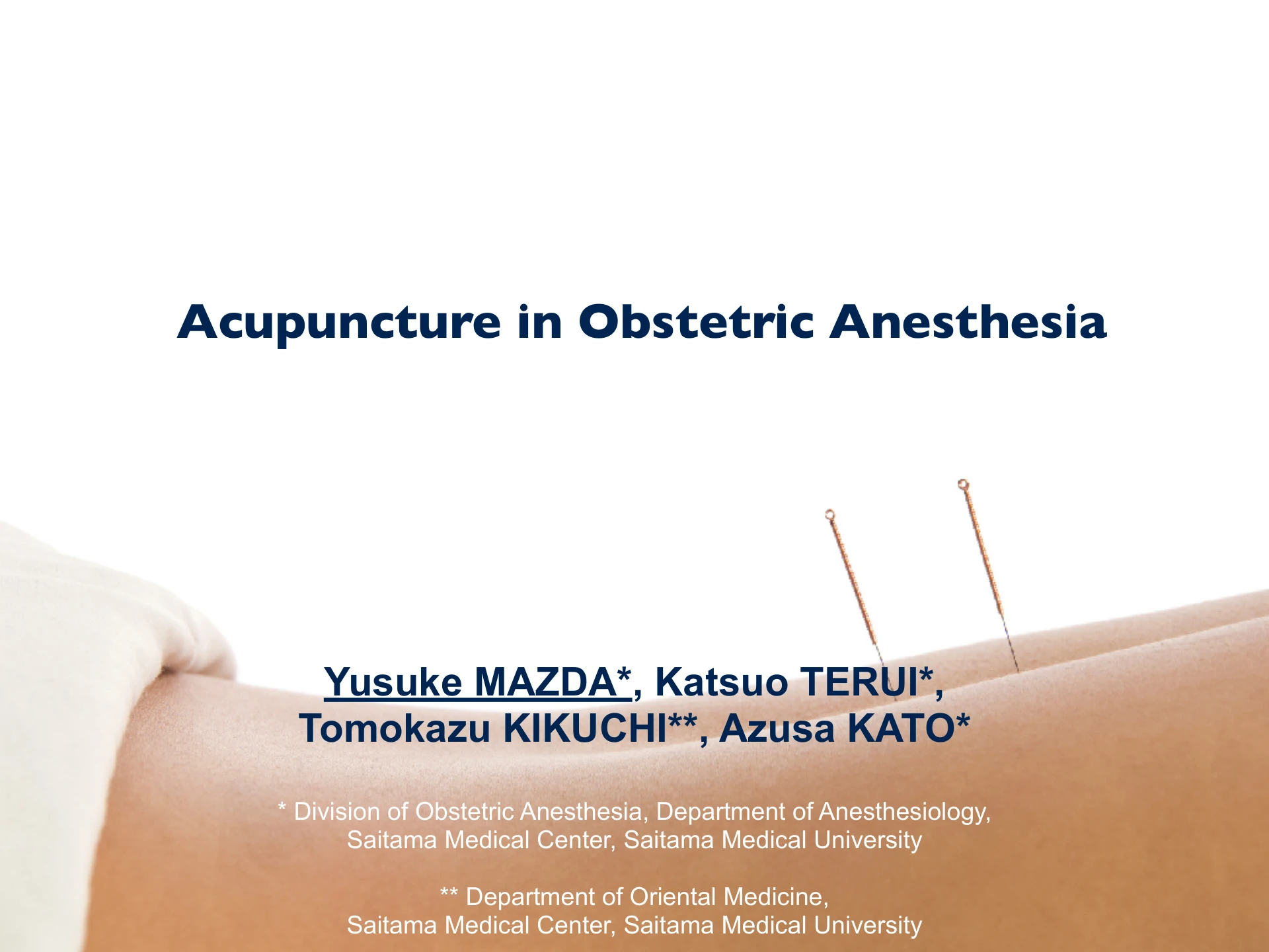 Acupuncture in Obstetric Anesthesia：１枚目